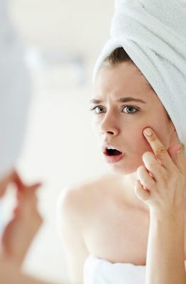 Evita el acné del periodo menstrual