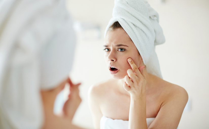 Evita el acné del periodo menstrual
